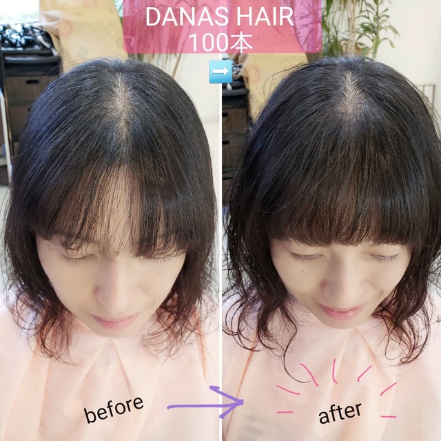 Danas Hairは女性の髪のコンプレックスに寄り添うサロン 新施術 Hair Loop ヘアループ で 前髪のパックリ割れ 後頭部のボリューム不足 など スタイリングの悩みにアプローチします 特集 Danas Hair 美容室 郡山市北部 ふくラボ